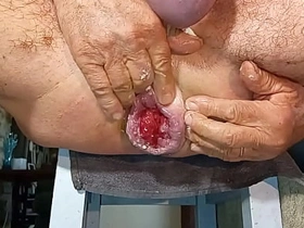 Gapingman 2025-14 asian gay sex videos asiangaysite