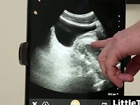 I wanted to watch my dick breed him with the ultrasound in whatever way - Littletwink merry asian merry sex videos