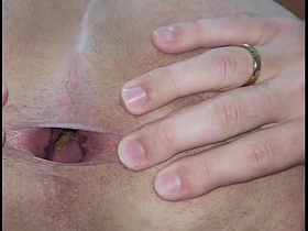 Cuzinho com surpresinha no fundinho 2 sex videos porn asian gay